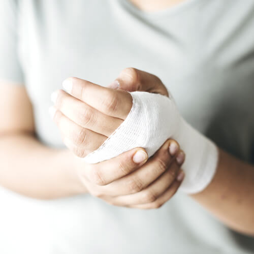 Опіки. Застосування продукції ТМ Примафлора в екстремальних ситуаціях.